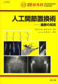 人工関節置換術 最新の知見 別冊整形外科