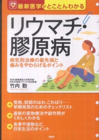リウマチ・膠原病 病気別治療の最先端と痛みをやわらげるポイント