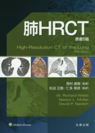 肺HRCT
