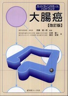 大腸癌