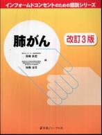 肺がん  改訂3版 インフォームドコンセントのための図説シリーズ