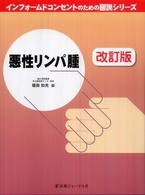 悪性リンパ腫