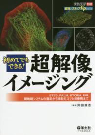 初めてでもできる!超解像イメージング STED、PALM、STORM、SIM、顕微鏡システムの選定から撮影のコツと撮像例まで 実験医学 ; 別冊 . 最強のステップUPシリーズ||サイキョウ ノ ステップ UP シリーズ