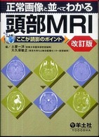 正常画像と並べてわかる頭部MRI ここが読影のポイント