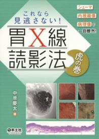 これなら見逃さない!胃X線読影法虎の巻 シェーマ+内視鏡像+病理像で一目瞭然!