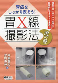 胃癌をしっかり表そう!胃X線撮影法虎の巻 撮影手技を基本から応用まで段階的にマスターできる!