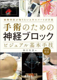 手術のための神経ﾌﾞﾛｯｸﾋﾞｼﾞｭｱﾙ基本手技 麻酔科医が知りたいｴｷｽﾊﾟｰﾄの手技