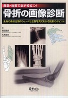 骨折の画像診断 救急・当直で必ず役立つ!  全身の骨折分類のシェーマと症例写真でわかる読影のポイント