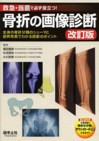 救急・当直で必ず役立つ!骨折の画像診断 全身の骨折分類のシェーマと症例写真でわかる読影のポイント