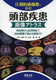 圧倒的画像数で診る!頭部疾患画像アトラス 典型例から応用例まで、2000画像で極める読影力!
