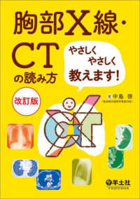 胸部X線・CTの読み方やさしくやさしく教えます!