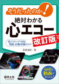 そうだったのか!絶対わかる心エコー 見てイメージできる判読・計測・評価のコツ