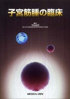 子宮筋腫の臨床