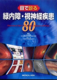 目で診る緑内障・視神経疾患80