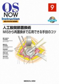 人工股関節置換術 MISから再置換まで応用できる手技のコツ
