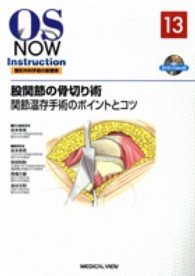 股関節の骨切り術 関節温存手術のポイントとコツ