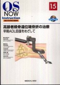 高齢者橈骨遠位端骨折の治療 早期ADL回復をめざして