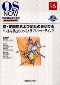膝・足関節および足趾の骨切り術 ベストな手技のコツ&トラブルシューティング