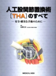 人工股関節置換術「THA」のすべて