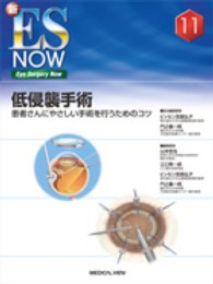 低侵襲手術 患者さんにやさしい手術を行うためのコツ