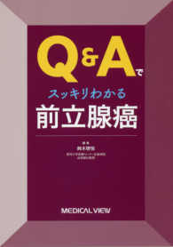Q&Aでスッキリわかる前立腺癌