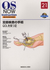 足部疾患の手術 QOLを保つ足