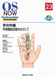 手の外傷 早期機能回復をめざして