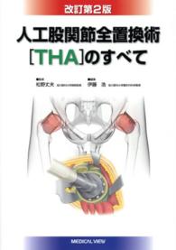 人工股関節全置換術「THA」のすべて