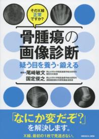 骨腫瘍の画像診断 そのX線正常ですか?. 疑う目を養う・鍛える