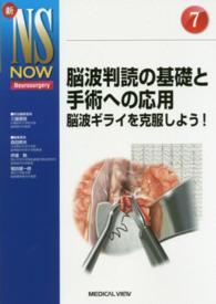 脳波判読の基礎と手術への応用 脳波ギライを克服しよう!