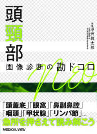 頭頸部画像診断の勘ドコロNEO