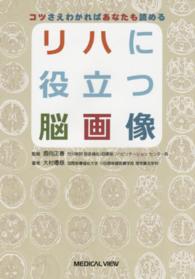 リハに役立つ脳画像 コツさえわかればあなたも読める