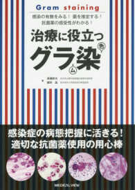 治療に役立つグラム染色 感染の有無をみる!菌を推定する!抗菌薬の感受性がわかる!