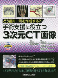 手術支援に役立つ3次元CT画像 どう撮り,何を作成する?