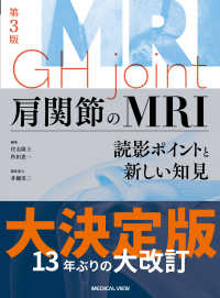 肩関節のMRI 読影ポイントと新しい知見