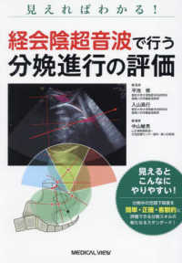 経会陰超音波で行う分娩進行の評価 見えればわかる!