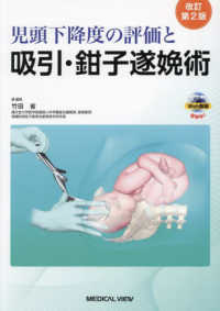 児頭下降度の評価と吸引・鉗子遂娩術  改訂第2版