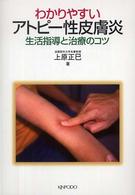 わかりやすいアトピー性皮膚炎 生活指導と治療のコツ