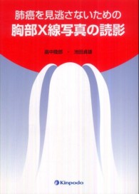 肺癌を見逃さないための胸部X線写真の読影