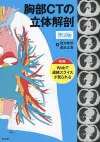 胸部CTの立体解剖