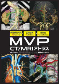 病変類似所見Mimickers・正常変異Variations・偽病変Pseudolesions MVP CT/MRIアトラス : electronic bk