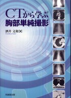 CTから学ぶ胸部単純撮影