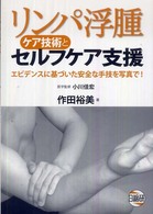 リンパ浮腫 ケア技術とセルフケア支援  エビデンスに基づいた安全な手技を写真で!