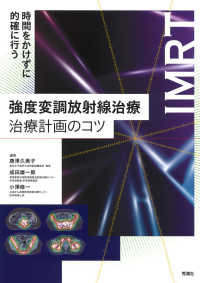 時間をかけずに的確に行う強度変調放射線治療治療計画のコツ IMRT