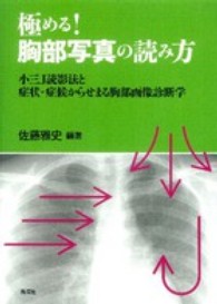 極める!胸部写真の読み方 小三J読影法と症状・症候からせまる胸部画像診断学