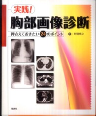 実践!胸部画像診断 押さえておきたい24のポイント