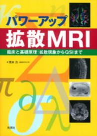 パワーアップ拡散MRI 臨床と基礎原理  拡散現象からQSIまで