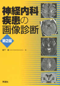 神経内科疾患の画像診断
