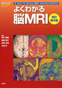 よくわかる脳MRI