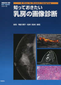 知っておきたい乳房の画像診断 画像診断別冊 : KEY BOOKシリーズ